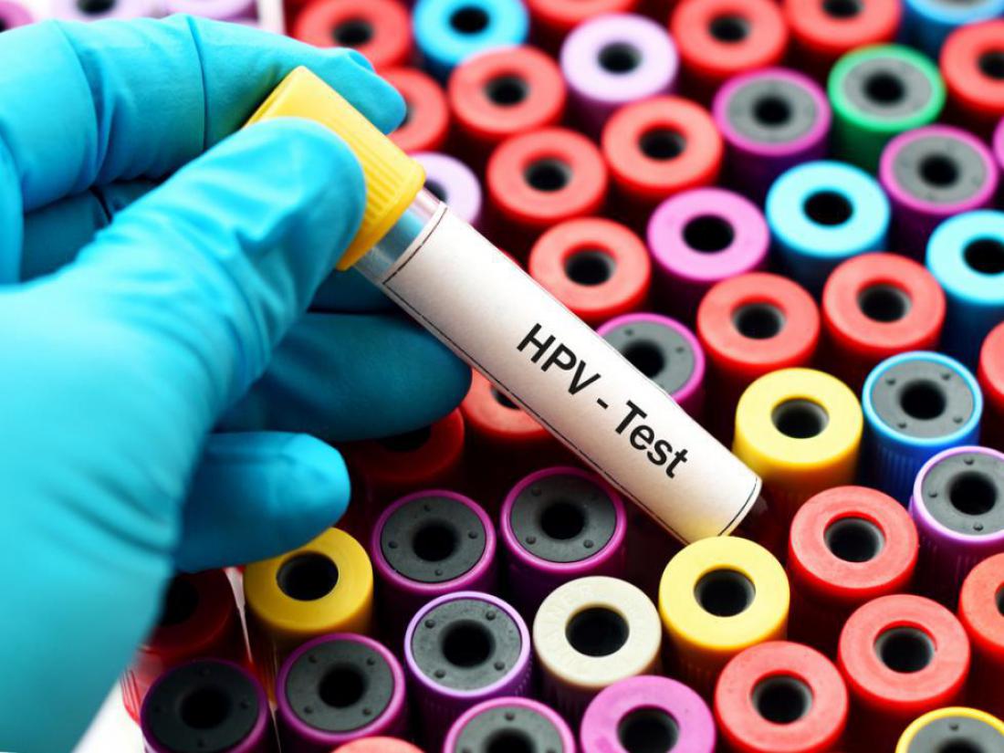 Vse, kar morate vedeti o HPV
